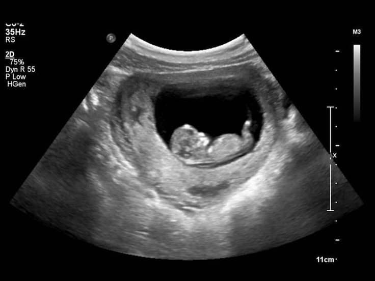 Post image - The Expensive Affair_SEX